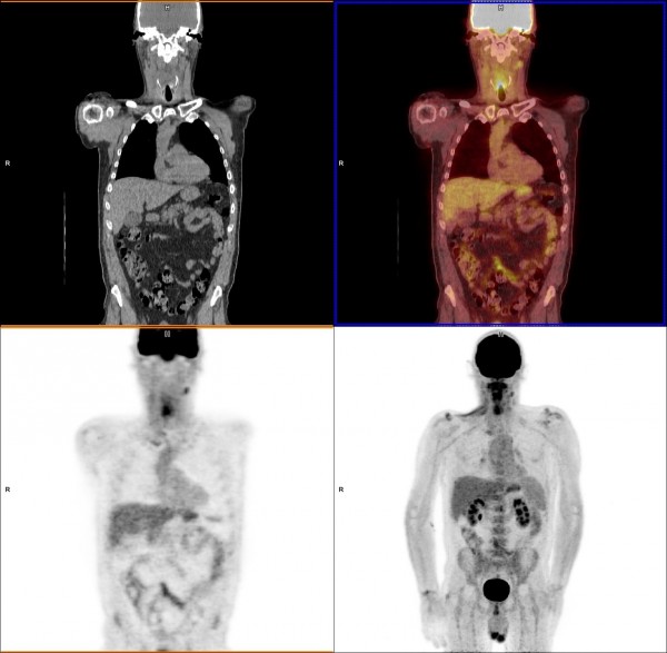 What is PET Imaging? | Imaging Technology News